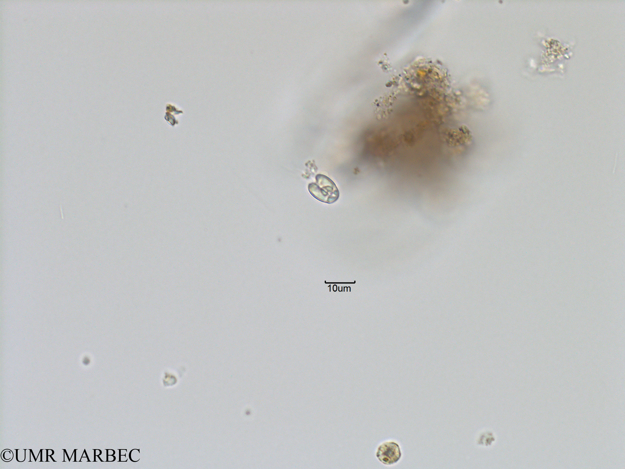 phyto/Bizerte/bizerte_bay/RISCO November 2015/Nanoflagellé 17 (Baie_T5-C1-Flagellé-2).tif(copy).jpg